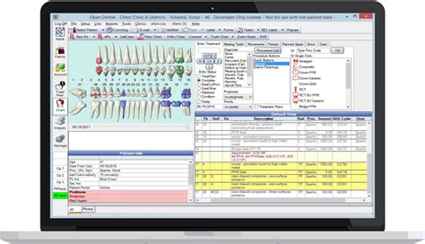 open dental credit card smart terminals|open dental software sign in.